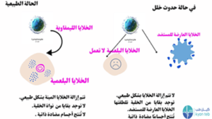 مرض الذئبة الحمراء