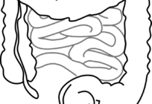 فيسيرالجين