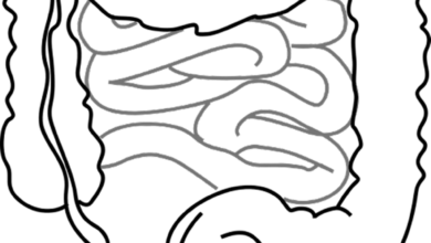 فيسيرالجين