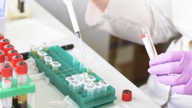 https://pixabay.com/photos/laboratory-medical-medicine-hand-3827736/