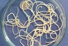 ديدان البطن