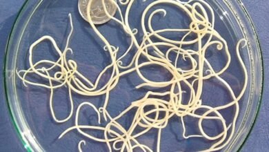 ديدان البطن