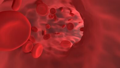 anemia