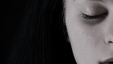 dark eye circles