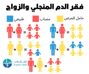 فقر الدم المنجلي