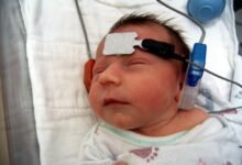 فحص السمع للمواليد