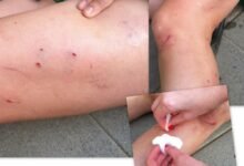 مخاطر خدش القطط