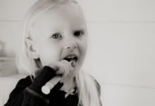 اسباب تسوس الأسنان الأمامية عند الأطفال