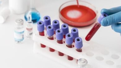 تحليل مخزون الحديد فريتين