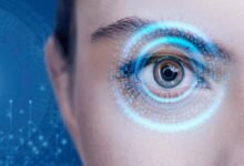 متلازمة التقشر الكاذب