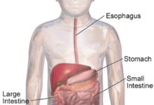 السيلياك عند الأطفال