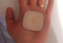 لصقة منع الحمل ايفرا