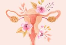 أسباب كيس الشعر على المبيض