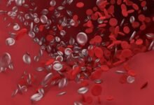 زيادة كرات الدم الحمراء عند الأطفال